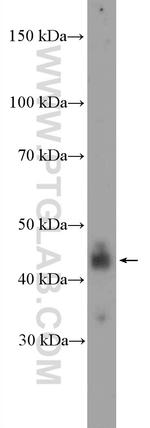 NFKBIL1 Antibody in Western Blot (WB)