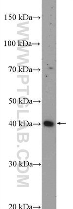 NFKBIL1 Antibody in Western Blot (WB)