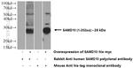 SAMD10 Antibody in Western Blot (WB)