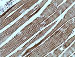 TRIM7 Antibody in Immunohistochemistry (Paraffin) (IHC (P))