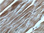 TRIM7 Antibody in Immunohistochemistry (Paraffin) (IHC (P))