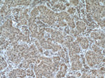 TRIM7 Antibody in Immunohistochemistry (Paraffin) (IHC (P))