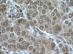 TRIM7 Antibody in Immunohistochemistry (Paraffin) (IHC (P))