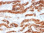 FGF21 (Fibroblast growth factor 21) Monoclonal Antibody (FGF21, 3691)
