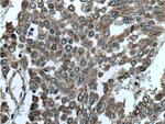 DALRD3 Antibody in Immunohistochemistry (Paraffin) (IHC (P))