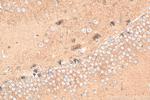 DDHD1 Antibody in Immunohistochemistry (Paraffin) (IHC (P))