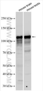 DDHD1 Antibody in Western Blot (WB)