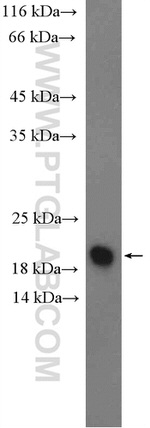 C19orf54 Antibody in Western Blot (WB)