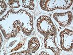 CCDC68 Antibody in Immunohistochemistry (Paraffin) (IHC (P))