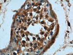 CCDC68 Antibody in Immunohistochemistry (Paraffin) (IHC (P))
