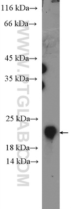 C1orf93 Antibody in Western Blot (WB)