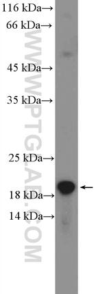 C1orf93 Antibody in Western Blot (WB)