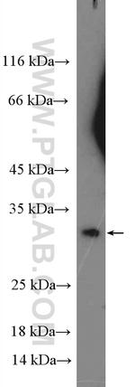 RNF144B/IBRDC2 Antibody in Western Blot (WB)