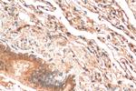 NFATC4 Antibody in Immunohistochemistry (Paraffin) (IHC (P))
