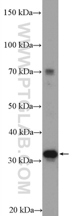 MCU/CCDC109A Antibody in Western Blot (WB)