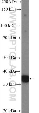 MCU/CCDC109A Antibody in Western Blot (WB)