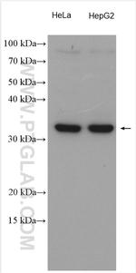 MCU/CCDC109A Antibody in Western Blot (WB)