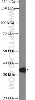 MCU/CCDC109A Antibody in Western Blot (WB)