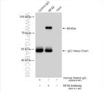 RFX2 Antibody in Immunoprecipitation (IP)