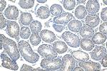 LRRCC1 Antibody in Immunohistochemistry (Paraffin) (IHC (P))