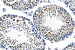 LRRCC1 Antibody in Immunohistochemistry (Paraffin) (IHC (P))