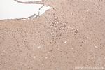 LRRCC1 Antibody in Immunohistochemistry (Paraffin) (IHC (P))