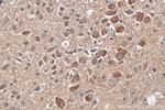 LRRCC1 Antibody in Immunohistochemistry (Paraffin) (IHC (P))