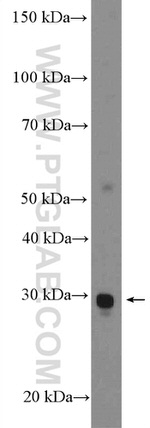C1orf71 Antibody in Western Blot (WB)