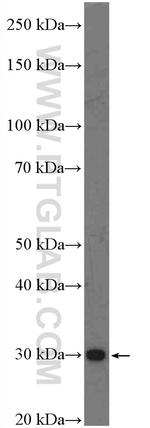 C1orf71 Antibody in Western Blot (WB)