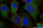 C17orf75 Antibody in Immunocytochemistry (ICC/IF)