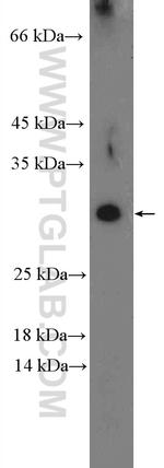 DYDC1 Antibody in Western Blot (WB)