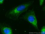 FAM134C Antibody in Immunocytochemistry (ICC/IF)