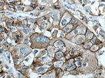 AE2 Antibody in Immunohistochemistry (Paraffin) (IHC (P))