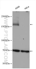 AE2 Antibody in Western Blot (WB)
