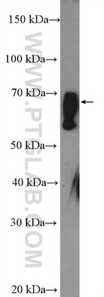ZNF169 Antibody in Western Blot (WB)