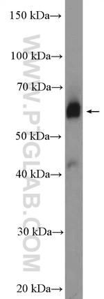ZNF169 Antibody in Western Blot (WB)