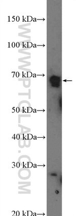 ZNF169 Antibody in Western Blot (WB)