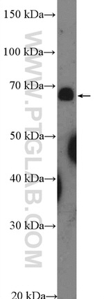 ZNF169 Antibody in Western Blot (WB)