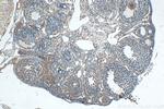 KIAA1109 Antibody in Immunohistochemistry (Paraffin) (IHC (P))