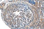KIAA1109 Antibody in Immunohistochemistry (Paraffin) (IHC (P))