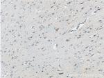 Neurofascin Antibody in Immunohistochemistry (Paraffin) (IHC (P))