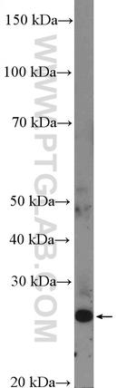 FLJ14213 Antibody in Western Blot (WB)
