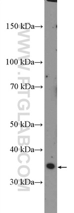 DCUN1D3 Antibody in Western Blot (WB)