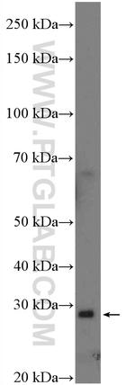 C20orf7 Antibody in Western Blot (WB)