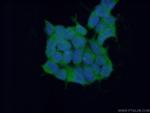 RNF14 Antibody in Immunocytochemistry (ICC/IF)