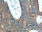 RNF14 Antibody in Immunohistochemistry (Paraffin) (IHC (P))