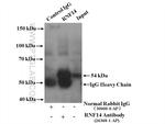 RNF14 Antibody in Immunoprecipitation (IP)