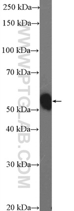 RNF14 Antibody in Western Blot (WB)
