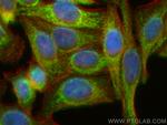 SLC25A36 Antibody in Immunocytochemistry (ICC/IF)
