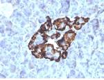 GC Vitamin D Binding Protein Monoclonal Antibody (VDBP/4481)